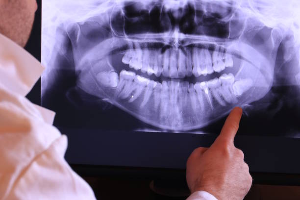 Best Emergency Cosmetic Dentistry in Flanders, NY